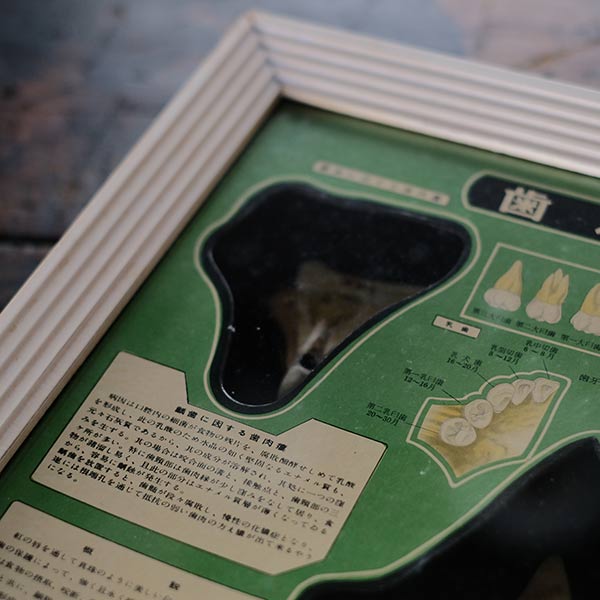 歯科標本
